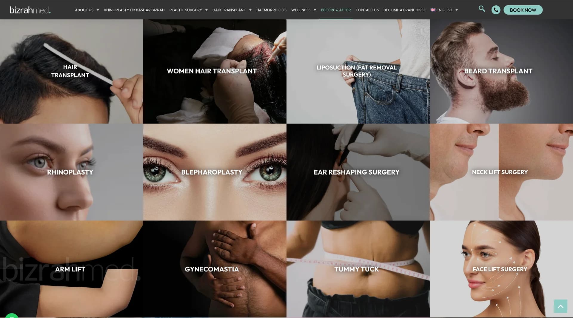 Bizrahmed Cosmetic Clinic gallery 2